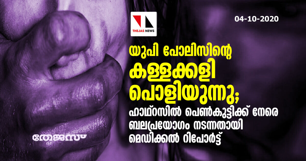 യുപി പോലിസിന്റെ കള്ളക്കളി പൊളിയുന്നു; ഹാഥ്റസില് പെണ്കുട്ടിക്ക് നേരെ ബലപ്രയോഗം നടന്നതായി മെഡിക്കല് റിപോര്ട്ട് യുപി പോലിസിന്റെ കള്ളക്കളി പൊളിയുന്നു; ഹാഥ്റസില് പെണ്കുട്ടിക്ക് നേരെ ബലപ്രയോഗം നടന്നതായി മെഡിക്കല് റിപോര്ട്ട്