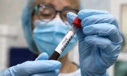 കൊവിഡ് 19 : ജില്ലയില് ഹോം ഐസൊലേഷനില് 5,872പേര് കൊവിഡ് 19 : ജില്ലയില് ഹോം ഐസൊലേഷനില് 5,872പേര്