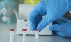 ഇടുക്കി ജില്ലയിൽ 120 പേർക്ക് കൂടി കൊവിഡ് സ്ഥിരീകരിച്ചു ഇടുക്കി ജില്ലയിൽ 120 പേർക്ക് കൂടി കൊവിഡ് സ്ഥിരീകരിച്ചു