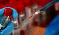 തിരുവനന്തപുരത്ത് ഇന്ന് 679 പേര്‍ക്ക് കൂടി കൊവിഡ്; 18 മരണം