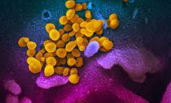 เดเตเดดเดฟเดเตเดเตเดเต เดเดฟเดฒเตเดฒเดฏเดฟเดฒเตโ 751 เดชเตเดฐเตโเดเตเดเต เดเตเดตเดฟเดกเต; 718 เดชเตเดฐเตโเดเตเดเต เดธเดฎเตเดชเดฐเตโเดเตเดเดคเตเดคเดฟเดฒเตเดเต เดเตเดดเดฟเดเตเดเตเดเต เดเดฟเดฒเตเดฒเดฏเดฟเดฒเตโ 751 เดชเตเดฐเตโเดเตเดเต เดเตเดตเดฟเดกเต; 718 เดชเตเดฐเตโเดเตเดเต เดธเดฎเตเดชเดฐเตโเดเตเดเดคเตเดคเดฟเดฒเตเดเต