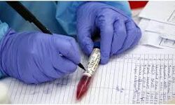 เดเดฐเตโเดฃเดพเดเดเดฏเดฟเดฒเตโ เดเดจเตเดจเต 3,691 เดชเตเดฐเตโเดเตเดเต เดเตเดตเดฟเดกเต เดเดฐเตโเดฃเดพเดเดเดฏเดฟเดฒเตโ เดเดจเตเดจเต 3,691 เดชเตเดฐเตโเดเตเดเต เดเตเดตเดฟเดกเต