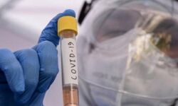 കുവൈത്തിൽ കൊവിഡ് ബാധിച്ച് 3 പേർ മരിച്ചു