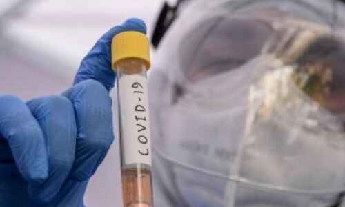 കുവൈത്തിൽ കൊവിഡ് ബാധിച്ച് 3 പേർ മരിച്ചു