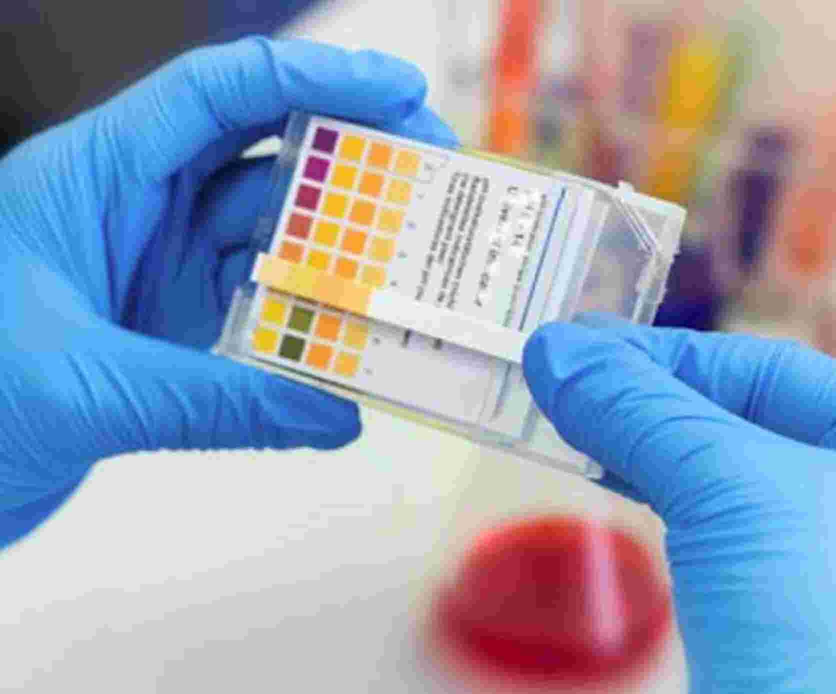 പാലക്കാട് ജില്ലയിൽ ഇന്ന് 424 പേർക്ക് കൊവിഡ് സ്ഥിരീകരിച്ചു പാലക്കാട് ജില്ലയിൽ ഇന്ന് 424 പേർക്ക് കൊവിഡ് സ്ഥിരീകരിച്ചു