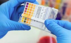 เดชเดพเดฒเดเตเดเดพเดเต เดเดฟเดฒเตเดฒเดฏเดฟเตฝ เดเดจเตเดจเต 424 เดชเตเตผเดเตเดเต เดเตเดตเดฟเดกเต เดธเตเดฅเดฟเดฐเตเดเดฐเดฟเดเตเดเต เดชเดพเดฒเดเตเดเดพเดเต เดเดฟเดฒเตเดฒเดฏเดฟเตฝ เดเดจเตเดจเต 424 เดชเตเตผเดเตเดเต เดเตเดตเดฟเดกเต เดธเตเดฅเดฟเดฐเตเดเดฐเดฟเดเตเดเต