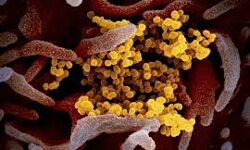 പാലക്കാട് ജില്ലയില് ഇന്ന് 351 പേര്ക്ക് കൊവിഡ്; 228 പേര്ക്ക് രോഗമുക്തി പാലക്കാട് ജില്ലയില് ഇന്ന് 351 പേര്ക്ക് കൊവിഡ്; 228 പേര്ക്ക് രോഗമുക്തി