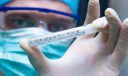 കോട്ടയം ജില്ലയില്‍ 387 പേര്‍ക്കുകൂടി കൊവിഡ് സ്ഥിരീകരിച്ചു