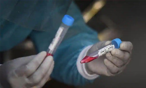 മലപ്പുറം ജില്ലയില്‍ ഇന്ന് 482 പേര്‍ക്ക് കൊവിഡ് സ്ഥിരീകരിച്ചു