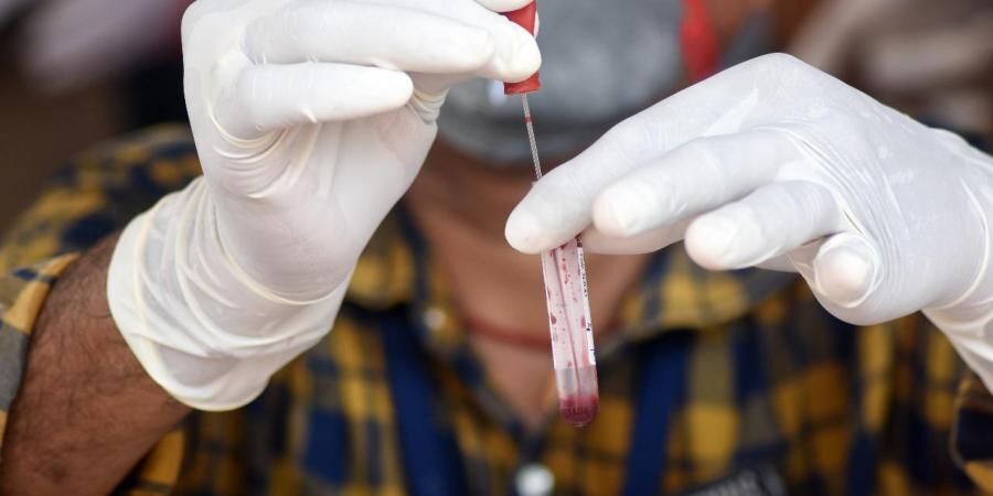 കോഴിക്കോട് ജില്ലയില് 674 പേര്ക്ക് കോവിഡ് : രോഗമുക്തി 581 കോഴിക്കോട് ജില്ലയില് 674 പേര്ക്ക് കോവിഡ് : രോഗമുക്തി 581