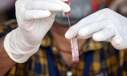 കോഴിക്കോട് ജില്ലയില്‍ 674 പേര്‍ക്ക് കോവിഡ് :   രോഗമുക്തി 581