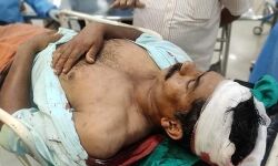 മട്ടന്നൂരിനടുത്ത് സിപിഎം നേതാവിനെ വെട്ടിപ്പരിക്കേല്‍പ്പിച്ചു