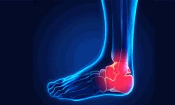 വിമാനാപകടത്തില്‍ പരിക്കേറ്റ യുവാവിന് ആശ്വാസമായി; ദക്ഷിണേന്ത്യയിലെ ആദ്യ കണങ്കാല്‍ മാറ്റിവെക്കല്‍ ശസ്ത്രക്രിയ മിംസില്‍