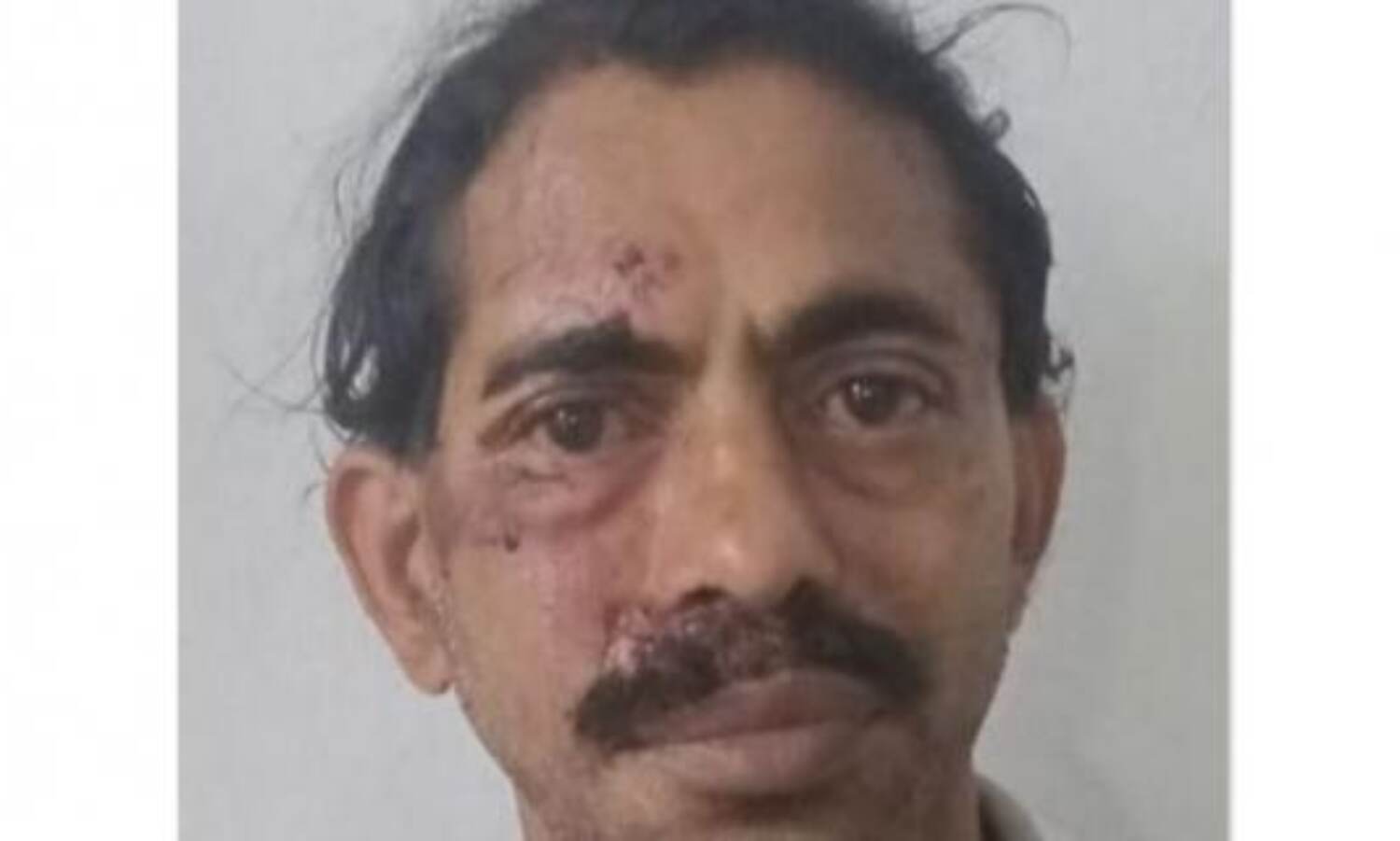 50കാരിയുടെ കാമുകന്മാര് തമ്മില് അടി: ഗുരുതരമായി പരുക്കേറ്റ യുവാവ് തീവ്രപരിചരണ വിഭാഗത്തില് 50കാരിയുടെ കാമുകന്മാര് തമ്മില് അടി: ഗുരുതരമായി പരുക്കേറ്റ യുവാവ് തീവ്രപരിചരണ വിഭാഗത്തില്