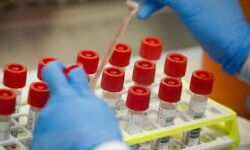 സംസ്ഥാനത്ത് ഇന്ന് കൊവിഡ് വാക്സിന്‍ സ്വീകരിച്ചത് 32,216 പേര്‍