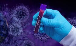 കാസര്‍കോട് ഇന്ന് 44 പേര്‍ക്ക് കൊവിഡ്; 72 പേര്‍ക്ക് രോഗമുക്തി