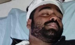 ഒറ്റപ്പാലത്ത് ആര്‍എസ്എസ് ആക്രമണം; എസ്എഫ്‌ഐ ഒറ്റപ്പാലം ഏരിയ വൈസ് പ്രസിഡന്റിന് പരിക്കേറ്റു