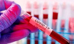 കേരളത്തില്‍ നിന്നും ബെംഗളൂരുവിലേക്ക് വരുന്നവര്‍ക്ക് കൊവിഡ് നെഗറ്റീവ് സര്‍ട്ടിഫിക്കറ്റ് നിര്‍ബന്ധമാക്കി.