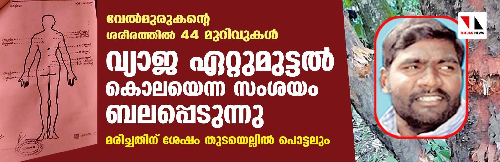 വ്യാജ ഏറ്റുമുട്ടൽ കൊലയെന്ന സംശയം ബലപ്പെടുന്നു; വേല്മുരുകന്റെ ശരീരത്തിൽ 44 മുറിവുകള്, മരിച്ചതിന് ശേഷം തുടയെല്ലിൽ പൊട്ടലും വ്യാജ ഏറ്റുമുട്ടൽ കൊലയെന്ന സംശയം ബലപ്പെടുന്നു; വേല്മുരുകന്റെ ശരീരത്തിൽ 44 മുറിവുകള്, മരിച്ചതിന് ശേഷം തുടയെല്ലിൽ പൊട്ടലും