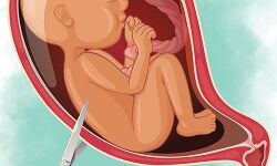 യുഎസിലെ അരാക്കന് സംസ്ഥാനം ഗര്ഭഛിദ്രം നിരോധിച്ച് നിയമം പാസാക്കി യുഎസിലെ അരാക്കന് സംസ്ഥാനം ഗര്ഭഛിദ്രം നിരോധിച്ച് നിയമം പാസാക്കി