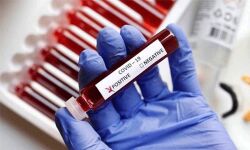 കോഴിക്കോട് ജില്ലയില്‍ 117 പേര്‍ക്ക് കൊവിഡ്; രോഗമുക്തി 334