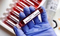 കൊവിഡ് 19: പൊതുജനം ഒരിക്കല് കൂടി അതീവ ജാഗ്രതയിലേക്ക് നീങ്ങണമെന്ന് ഡിഎംഒ കൊവിഡ് 19: പൊതുജനം ഒരിക്കല് കൂടി അതീവ ജാഗ്രതയിലേക്ക് നീങ്ങണമെന്ന് ഡിഎംഒ