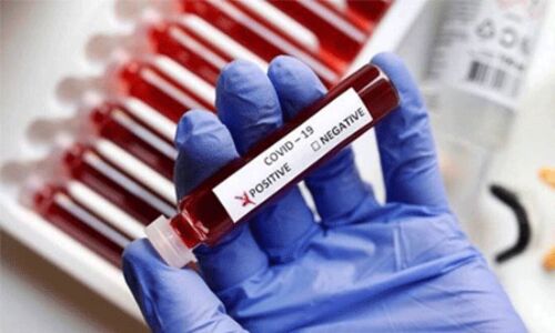 വയനാട് ജില്ലയില് 70 പേര്ക്ക് കൂടി കൊവിഡ് വയനാട് ജില്ലയില് 70 പേര്ക്ക് കൂടി കൊവിഡ്