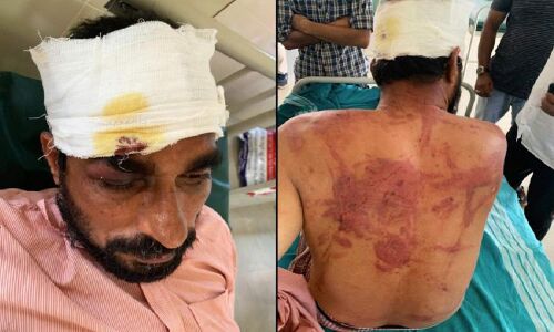 കര്ണാകടയില് മുസ്ലിം യുവാക്കള്ക്ക് ക്രൂരമര്ദ്ദനം; അഞ്ച് ബജ്രംഗ്ദള് പ്രവര്ത്തകര് അറസ്റ്റില് കര്ണാകടയില് മുസ്ലിം യുവാക്കള്ക്ക് ക്രൂരമര്ദ്ദനം; അഞ്ച് ബജ്രംഗ്ദള് പ്രവര്ത്തകര് അറസ്റ്റില്