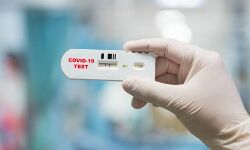 เดเตเดดเดฟเดเตเดเตเดเต เดเดฟเดฒเตเดฒเดฏเดฟเตฝ 5554 เดชเตเตผเดเตเดเตเดเตเดเดฟ เดเตเดตเดฟเดกเต; เดเดฟเดชเดฟเดเตผ- 30.98 เดถเดคเดฎเดพเดจเด เดเตเดดเดฟเดเตเดเตเดเต เดเดฟเดฒเตเดฒเดฏเดฟเตฝ 5554 เดชเตเตผเดเตเดเตเดเตเดเดฟ เดเตเดตเดฟเดกเต; เดเดฟเดชเดฟเดเตผ- 30.98 เดถเดคเดฎเดพเดจเด