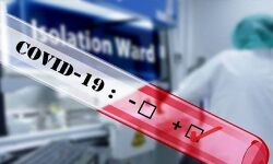 കോഴിക്കോട് ജില്ലയില്‍ 2,760 പേര്‍ക്ക് കൊവിഡ്; രോഗമുക്തി 3912, ടി.പി.ആര്‍ 24.82 %