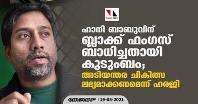 ഹാനി ബാബുവിന് ബ്ലാക്ക് ഫംഗസ് ബാധിച്ചതായി കുടുംബം; അടിയന്തര ചികിത്സ ലഭ്യമാക്കണമെന്ന് ഹരജി