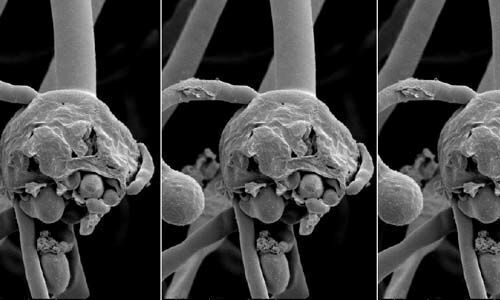 ബ്ലാക്ക് ഫംഗസിനെ പകര്ച്ചവ്യാധിയായി പ്രഖ്യാപിച്ച് രാജസ്ഥാന് ബ്ലാക്ക് ഫംഗസിനെ പകര്ച്ചവ്യാധിയായി പ്രഖ്യാപിച്ച് രാജസ്ഥാന്