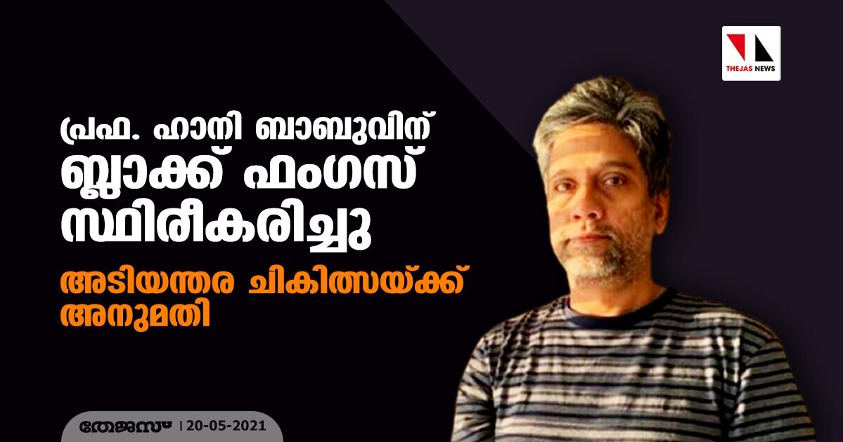പ്രഫ. ഹാനി ബാബുവിന് ബ്ലാക്ക് ഫംഗസ് സ്ഥിരീകരിച്ചു; അടിയന്തര ചികിത്സയ്ക്ക് അനുമതി