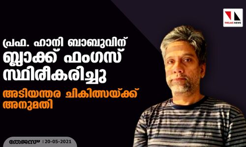 പ്രഫ. ഹാനി ബാബുവിന് ബ്ലാക്ക് ഫംഗസ് സ്ഥിരീകരിച്ചു; അടിയന്തര ചികിത്സയ്ക്ക് അനുമതി