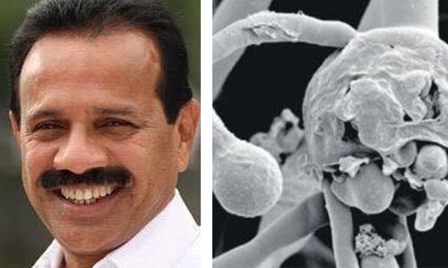 ബ്ലാക്ക് ഫംഗസ്: കേന്ദ്ര സര്ക്കാര് സംസ്ഥാനങ്ങള്ക്ക് കൂടുതലായി 23,680 ആംഫോട്ടെറിസിന്-ബി വയലുകള് നല്കും ബ്ലാക്ക് ഫംഗസ്: കേന്ദ്ര സര്ക്കാര് സംസ്ഥാനങ്ങള്ക്ക് കൂടുതലായി 23,680 ആംഫോട്ടെറിസിന്-ബി വയലുകള് നല്കും