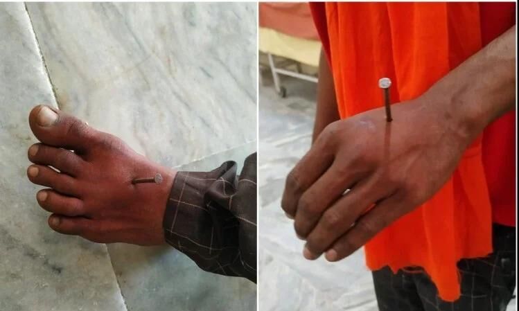 മാസ്ക് ധരിക്കാത്തതിന് കൈകാലുകളില് ആണിയടിച്ചെന്ന ആരോപണം നിഷേധിച്ച് യുപി പോലിസ് മാസ്ക് ധരിക്കാത്തതിന് കൈകാലുകളില് ആണിയടിച്ചെന്ന ആരോപണം നിഷേധിച്ച് യുപി പോലിസ്