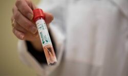 കോട്ടയം ജില്ലയില്‍ 846 പേര്‍ക്ക് കൊവിഡ്; ടെസ്റ്റ് പോസിറ്റിവിറ്റി നിരക്ക് 14.19 ശതമാനം