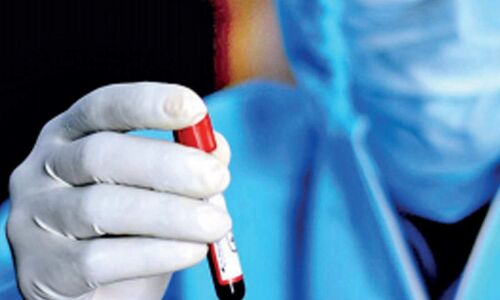 കൊവിഡ് 19; മലപ്പുറത്ത് 1,689 പേര്‍ക്ക് വൈറസ് ബാധ; 3,508 പേര്‍ക്ക് രോഗമുക്തി