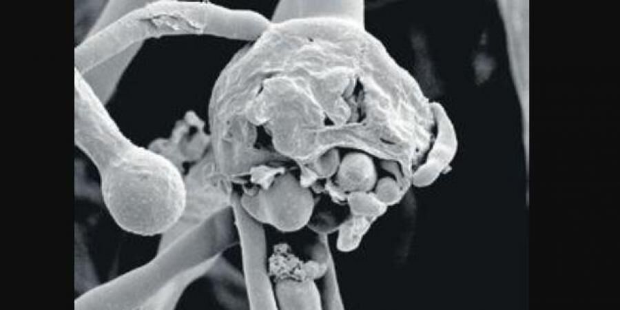 മഞ്ചേരി മെഡിക്കല്‍ കോളജില്‍ ബ്ലാക്ക് ഫംഗസ് മരണം