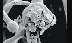 മഞ്ചേരി മെഡിക്കല്‍ കോളജില്‍ ബ്ലാക്ക് ഫംഗസ് മരണം