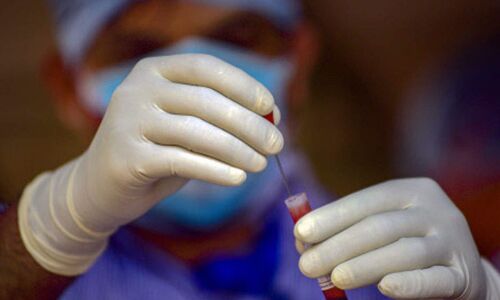 വയനാട് ജില്ലയില്‍ 272 പേര്‍ക്ക് കൂടി കൊവിഡ്