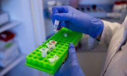 മോണോക്ലോണല്‍ ആന്റിബോഡി മിശ്രിതമുപയോഗിച്ച് കൊവിഡ് ചികില്‍സ; ഫലപ്രദമെന്ന് മുംബൈയിലെ സ്വകാര്യ ആശുപത്രികള്‍