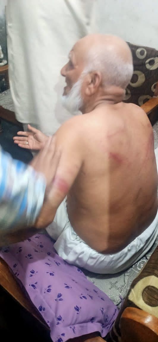 ജയ്ശ്രീരാം വിളിക്കാന് ആവശ്യപ്പെട്ട് വൃദ്ധനെ മര്ദ്ദിച്ചതില് കേസെടുത്തത് പണം തട്ടിപ്പറിച്ചതിന് മാത്രം ജയ്ശ്രീരാം വിളിക്കാന് ആവശ്യപ്പെട്ട് വൃദ്ധനെ മര്ദ്ദിച്ചതില് കേസെടുത്തത് പണം തട്ടിപ്പറിച്ചതിന് മാത്രം