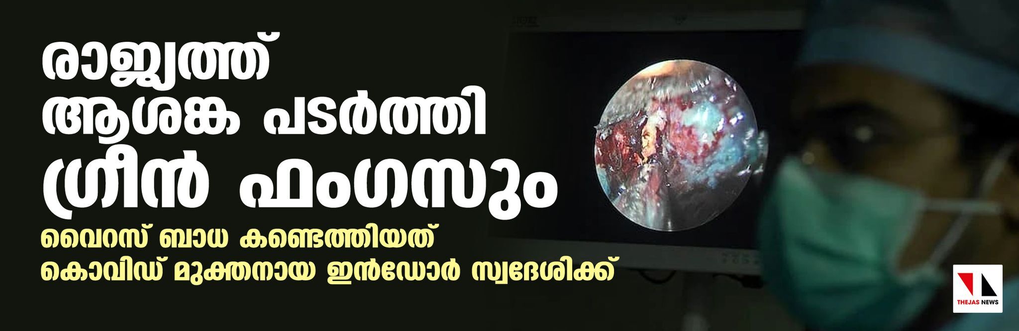 രാജ്യത്ത് ആശങ്ക പടര്‍ത്തി ഗ്രീന്‍ ഫംഗസും; വൈറസ് ബാധ കണ്ടെത്തിയത് കൊവിഡ് മുക്തനായ ഇന്‍ഡോര്‍ സ്വദേശിക്ക്