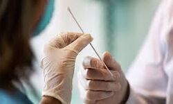 เดตเดฏเดจเดพเดเต เดเดฟเดฒเตเดฒเดฏเดฟเดฒเตโ 175 เดชเตเดฐเตโเดเตเดเต เดเตเดเดฟ เดเตเดตเดฟเดกเต; 263 เดชเตเดฐเตโเดเตเดเต เดฐเตเดเดฎเตเดเตเดคเดฟ, เดเตเดธเตเดฑเตเดฑเต เดชเตเดธเดฟเดฑเตเดฑเดฟเดตเดฟเดฑเตเดฑเดฟ เดฑเตเดฑเตเดฑเต 9.25 เดตเดฏเดจเดพเดเต เดเดฟเดฒเตเดฒเดฏเดฟเดฒเตโ 175 เดชเตเดฐเตโเดเตเดเต เดเตเดเดฟ เดเตเดตเดฟเดกเต; 263 เดชเตเดฐเตโเดเตเดเต เดฐเตเดเดฎเตเดเตเดคเดฟ, เดเตเดธเตเดฑเตเดฑเต เดชเตเดธเดฟเดฑเตเดฑเดฟเดตเดฟเดฑเตเดฑเดฟ เดฑเตเดฑเตเดฑเต 9.25