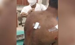 എടത്തനാട്ടുകരയില് കടുവയുടെ ആക്രമണം; ടാപ്പിങ് തൊഴിലാളിക്ക് പരുക്ക് എടത്തനാട്ടുകരയില് കടുവയുടെ ആക്രമണം; ടാപ്പിങ് തൊഴിലാളിക്ക് പരുക്ക്