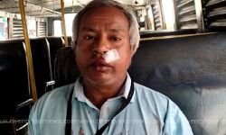 മദ്യപാനിയുടെ ആക്രമണത്തില്‍ കെഎസ്ആര്‍ടിസി കണ്ടക്ടര്‍ക്ക് പരിക്ക്