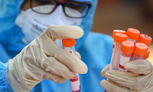 മലപ്പുറത്തിന്റെ പ്രാണവായു പദ്ധതി: മലപ്പുറംകാരുടെ പോക്കറ്റടിക്കാനുള്ള ശ്രമമെന്ന്; സാമൂഹികമാധ്യമങ്ങളില് കടുത്ത പ്രതിഷേധം മലപ്പുറത്തിന്റെ പ്രാണവായു പദ്ധതി: മലപ്പുറംകാരുടെ പോക്കറ്റടിക്കാനുള്ള ശ്രമമെന്ന്; സാമൂഹികമാധ്യമങ്ങളില് കടുത്ത പ്രതിഷേധം