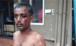 കൊടുവള്ളിയില്‍ കവര്‍ച്ച തടയാന്‍ ശ്രമിച്ച ജാര്‍ഖണ്ഡ് സ്വദേശിയെ ബൈക്കില്‍ വലിച്ചിഴച്ചു