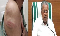 മലപ്പുറത്ത് മാധ്യമപ്രവര്‍ത്തകന് പോലിസ് മര്‍ദ്ദനം; പരിശോധനയും നടപടിയുമുണ്ടാകുമെന്ന് മുഖ്യമന്ത്രി